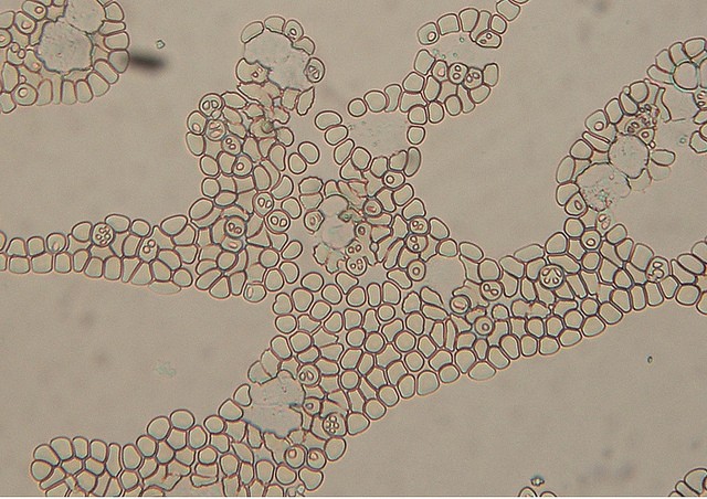 Babesia canis piroplasmosi
